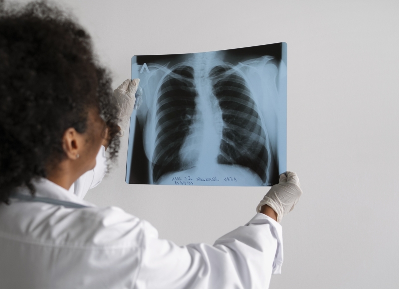 Busca Ativa de casos de Tuberculose